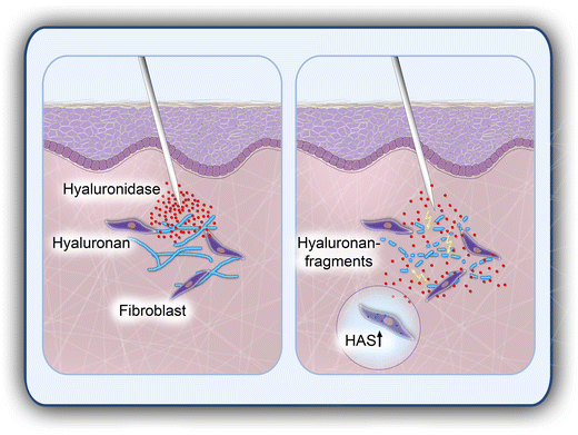 dissolving filler