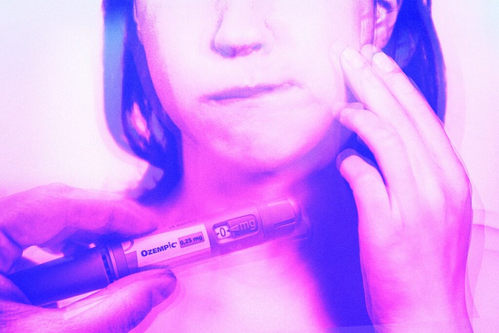 how to get rid of ozempic face naturally
